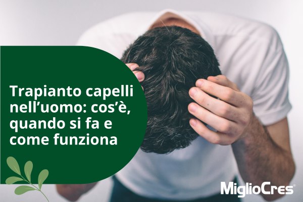 Trapianto capelli nell’uomo: tutto ciò che devi sapere